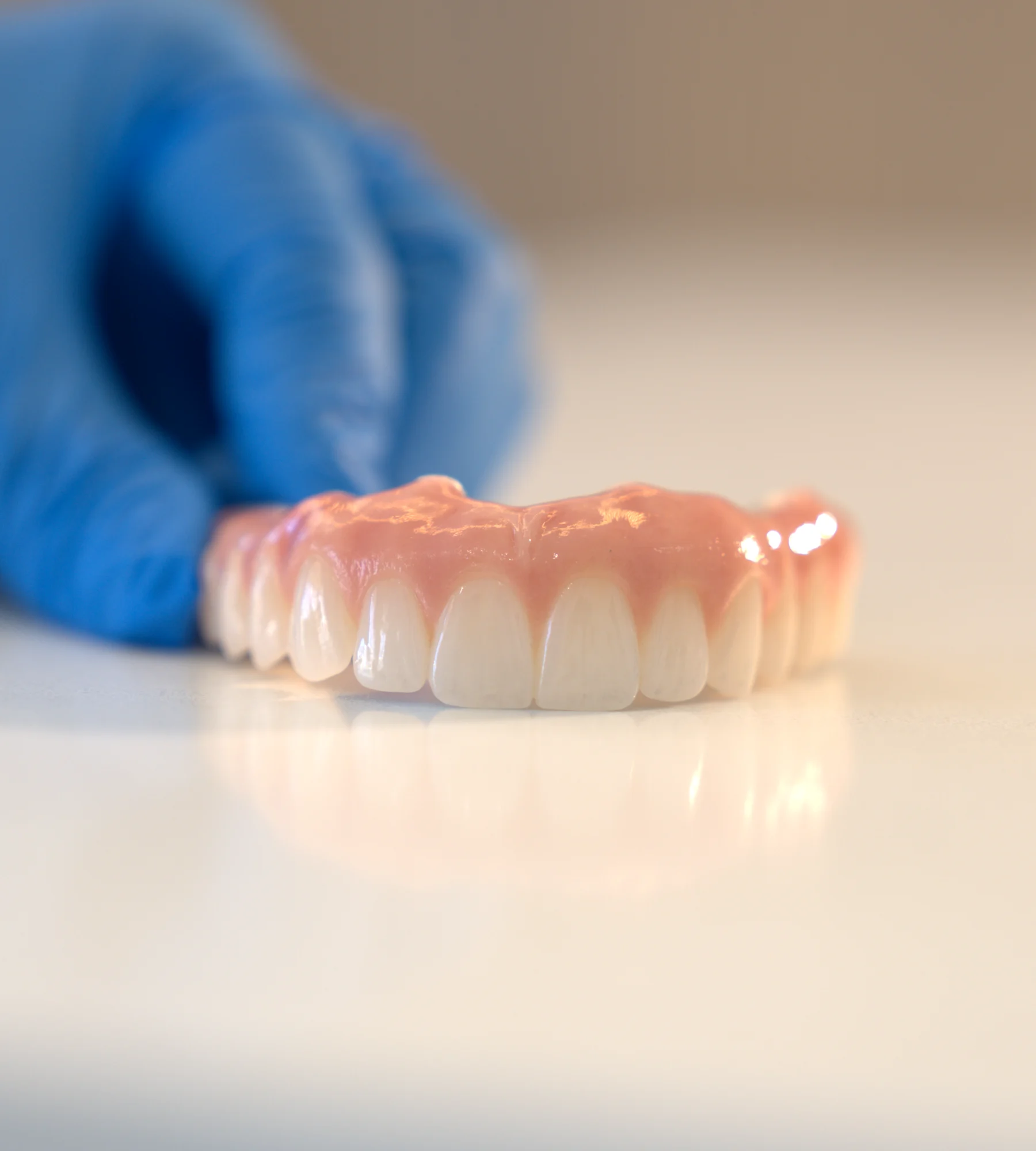 Monolithic zirconia All-on-X full-arch restoration — Smile Spot Dentistry, Venice, FL