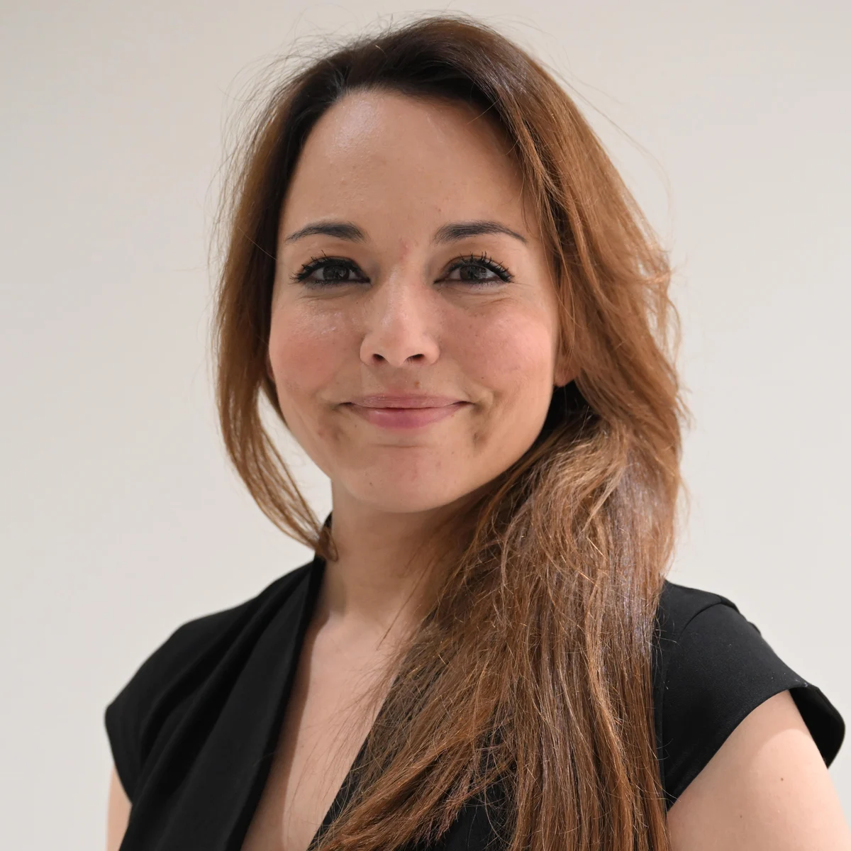 Relaxed, natural expression after Botox treatment at Smile Spot Dentistry