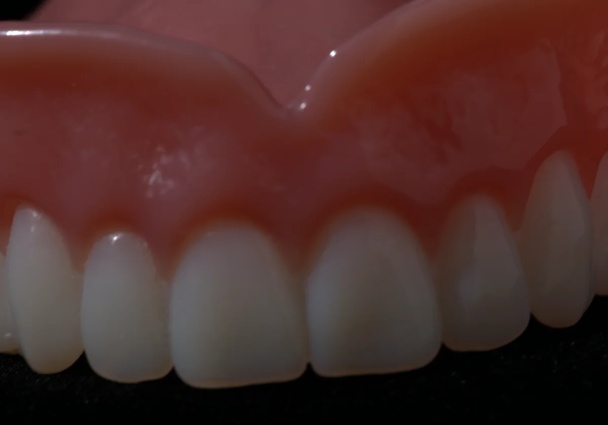 Premium denture gingival acrylic showing hand-characterization — colour graduation from lighter contact areas to richer pink at depth, replicating living gum tissue variation. Smile Spot Dentistry Venice FL.
