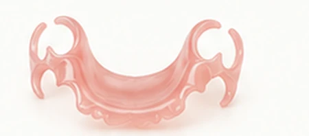 Flexible thermoplastic Valplast partial denture framework — Smile Spot Dentistry, Venice FL