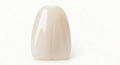 Porcelain denture tooth — Smile Spot Dentistry, Venice FL