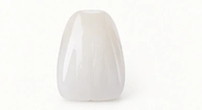 Zirconia denture tooth — Smile Spot Dentistry, Venice FL