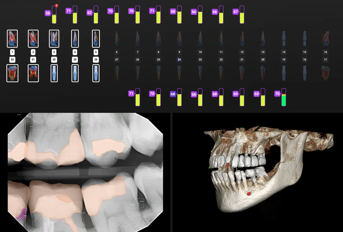 Diagnostic data: Innerview mobility scan, Pearl AI radiograph and CBCT 3D scan