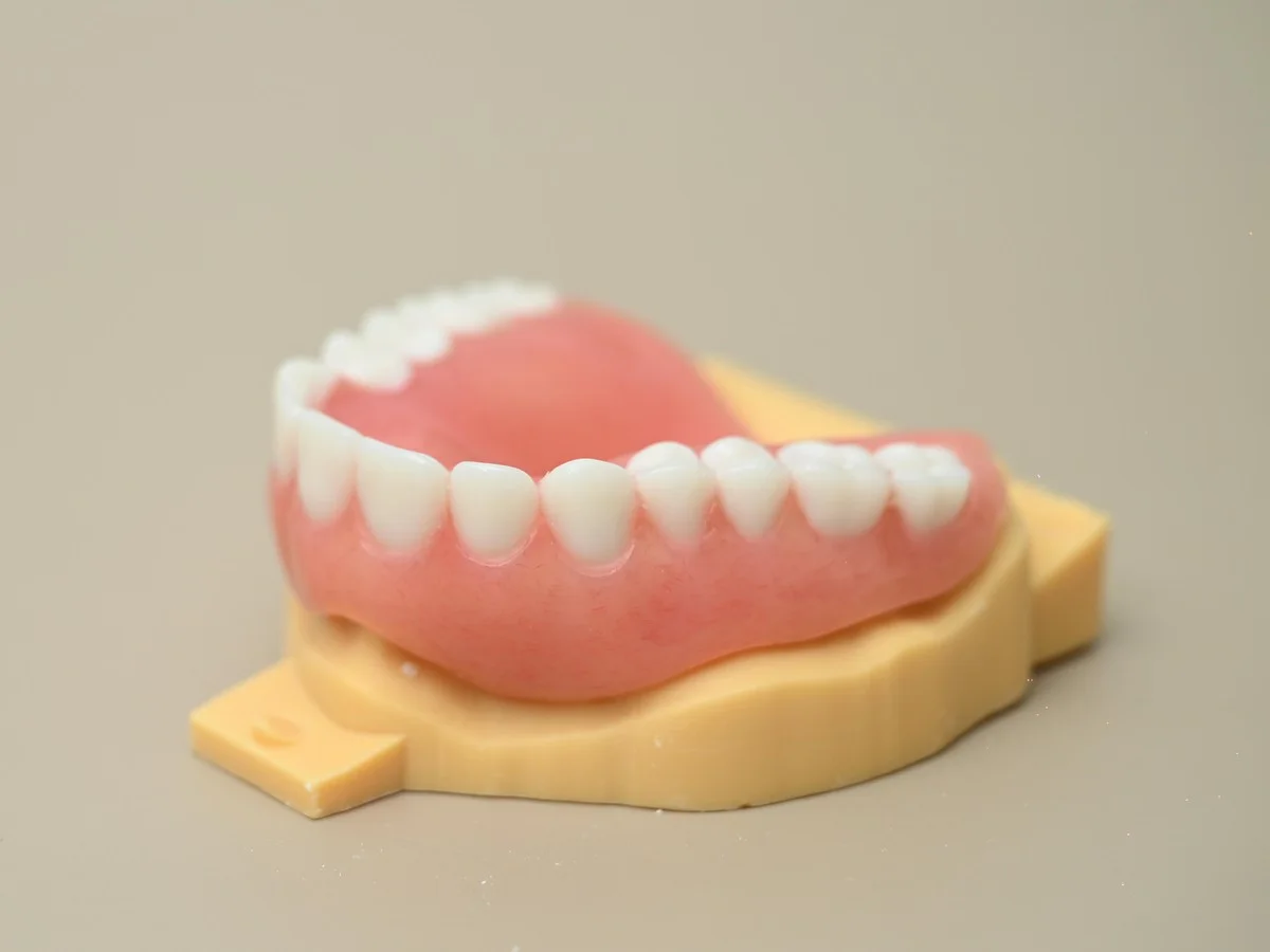 Immediate same-day denture — Smile Spot Dentistry, Venice FL