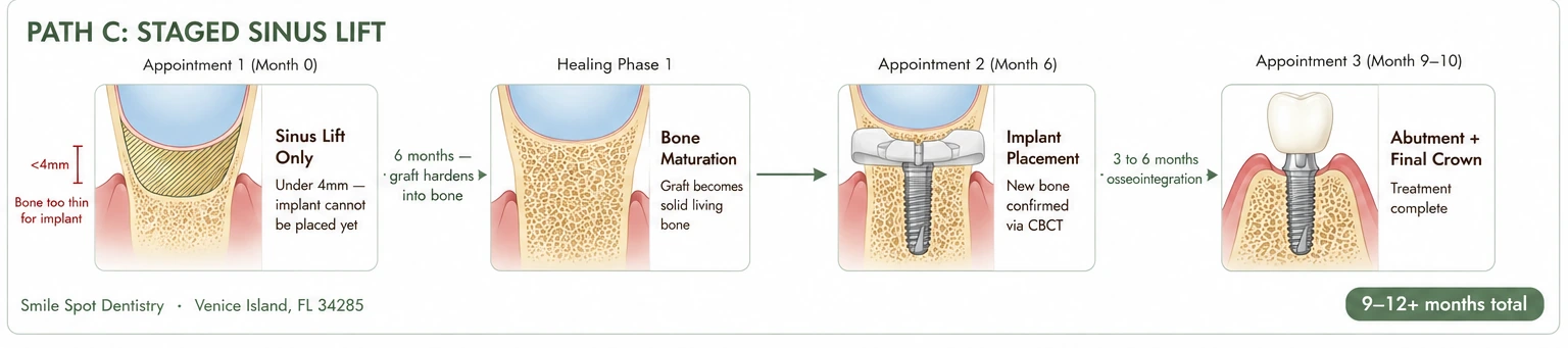 Path C: Staged sinus lift — stage by stage, Smile Spot Dentistry, Venice, FL