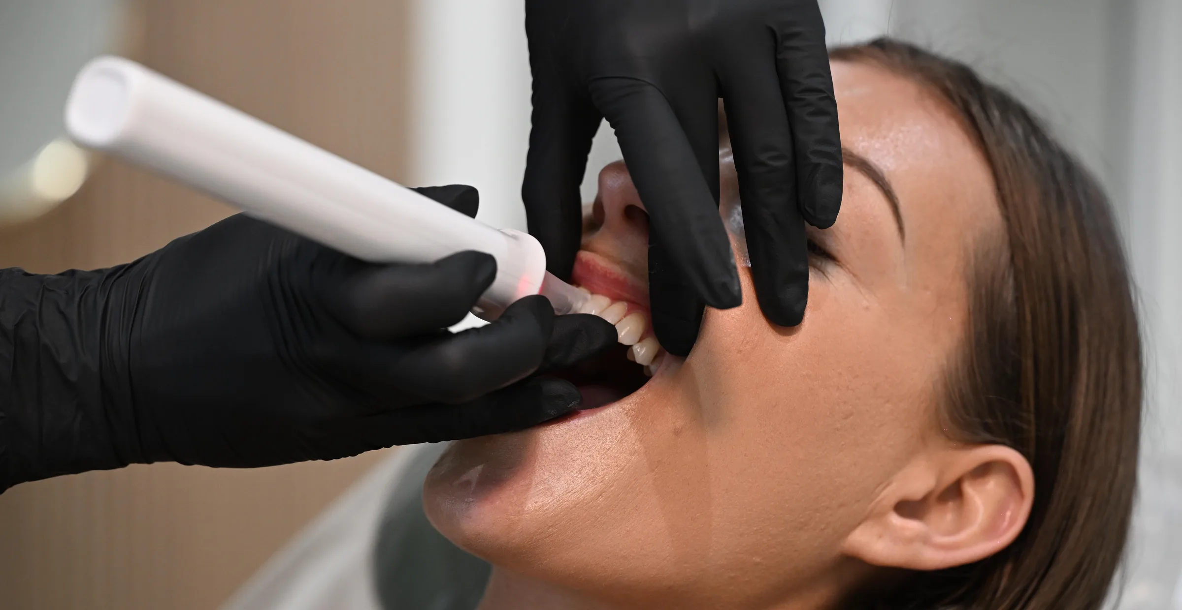 Innerview handpiece measuring a front tooth at Smile Spot Dentistry, Venice FL