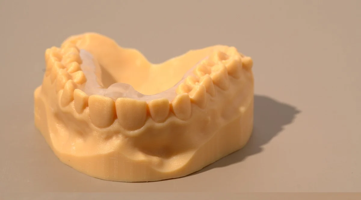Kois Deprogrammer on a dental model — Smile Spot Dentistry, Venice FL