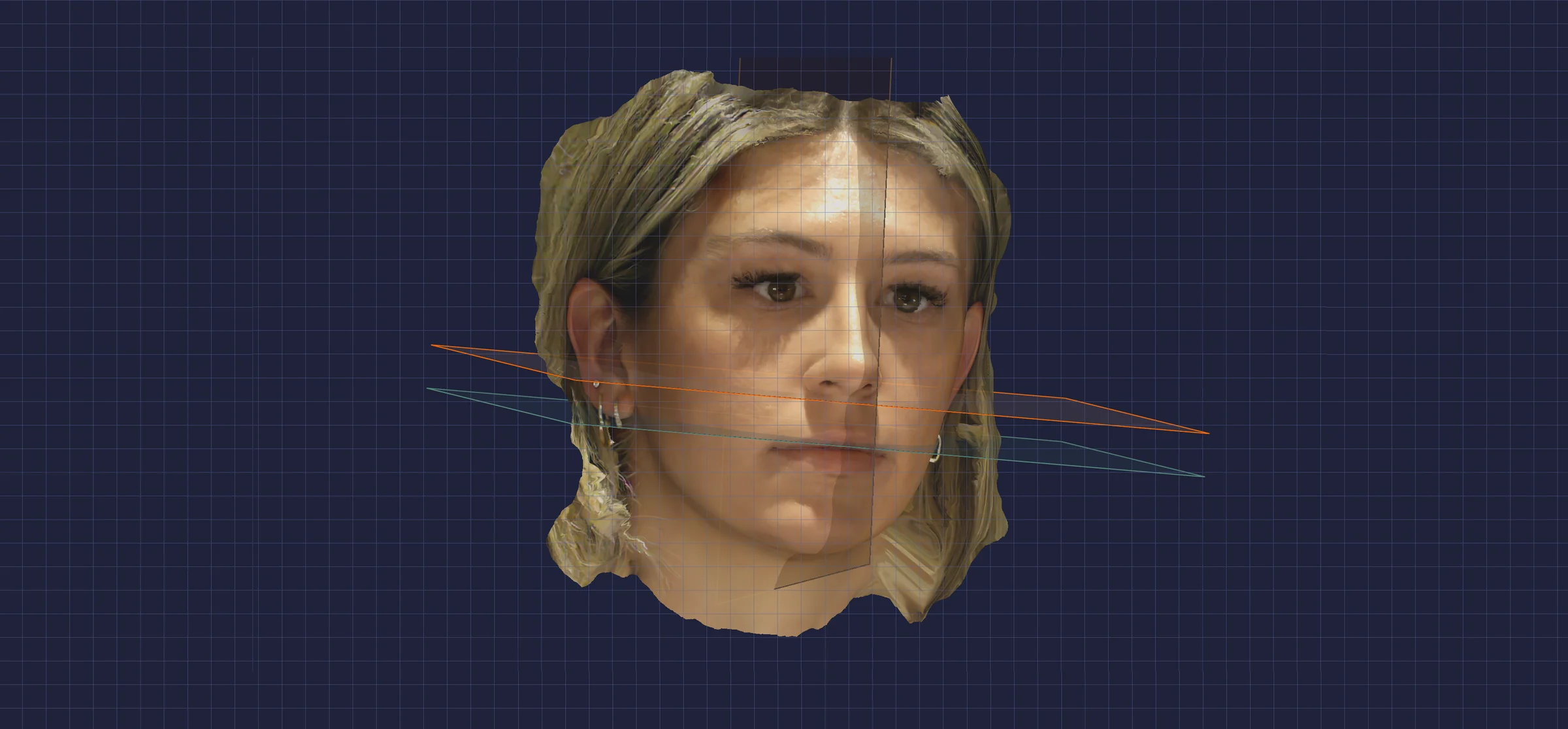 RAYFace software showing a 3D facial scan with facial reference planes for smile design