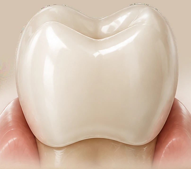 Biomimetic ceramic crown with full coverage — Smile Spot Dentistry, Venice FL
