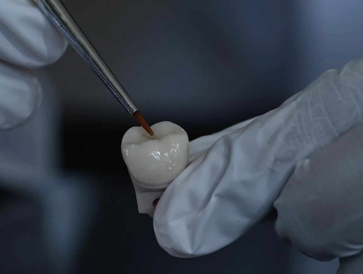 Finished ceramic crown held and refined by hand before seating — Smile Spot Dentistry, Venice FL