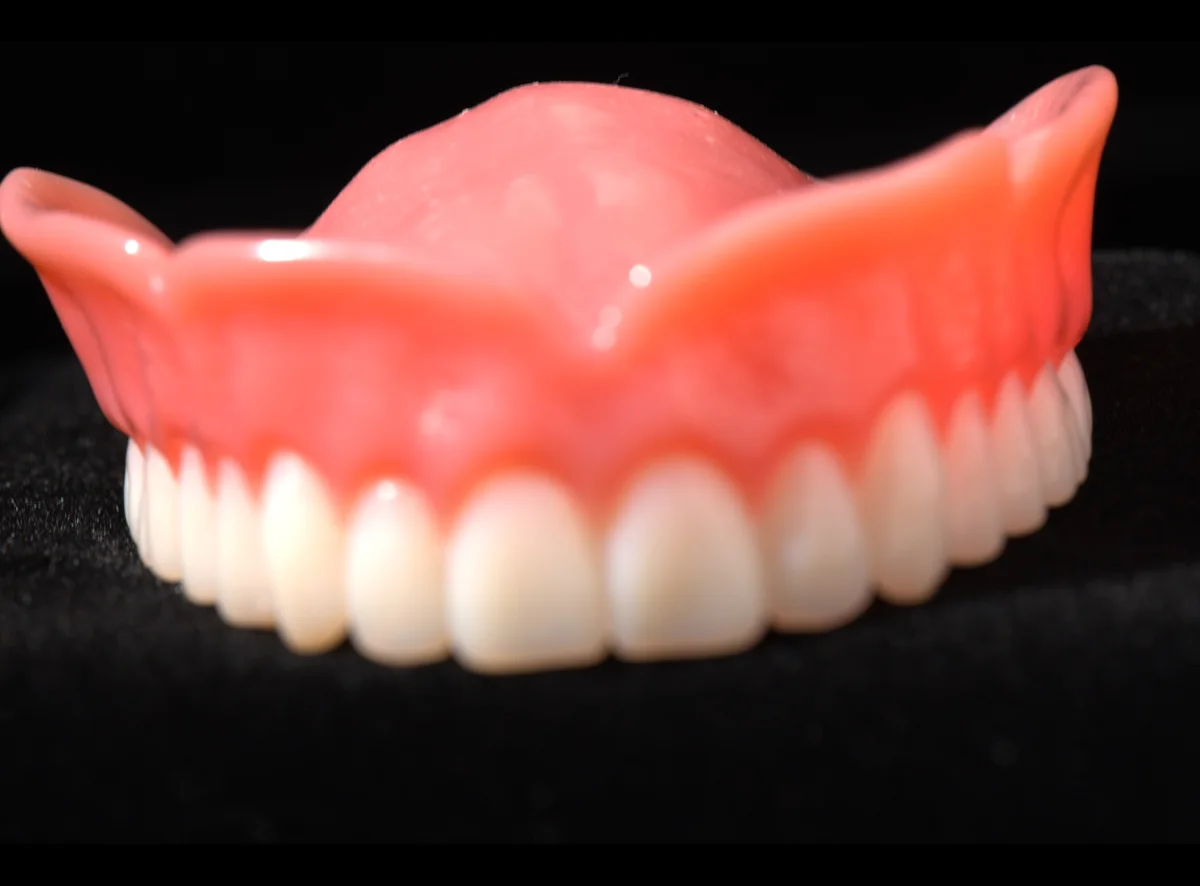 Complete upper denture with natural-looking teeth set in pink acrylic gum
