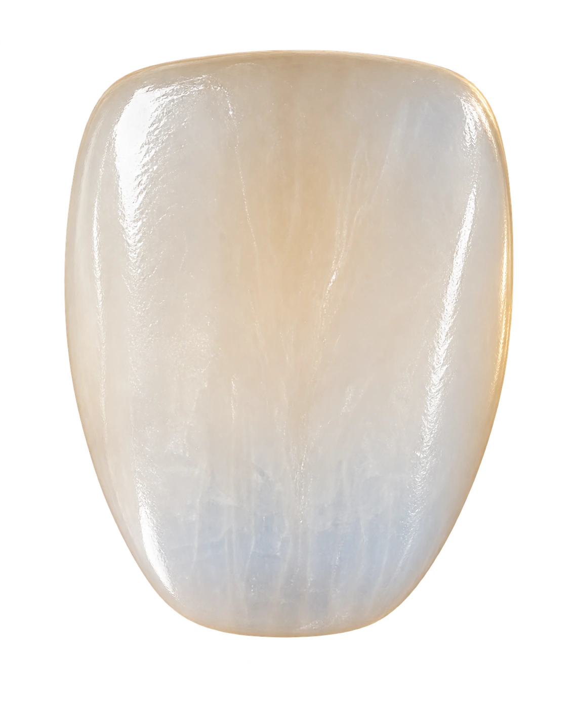 A Smile Spot veneer shell — layered translucency, cervical warmth and natural surface texture